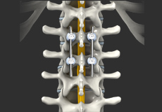 Thoracic Spine Anatomy